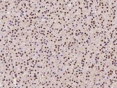 Immunohistochemistry-Paraffin: TIF1 gamma Antibody [NBP2-98000]
