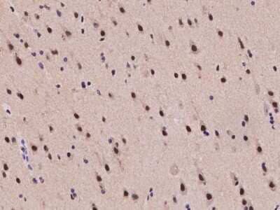 Immunohistochemistry-Paraffin: TIF1 gamma Antibody [NBP2-98000]