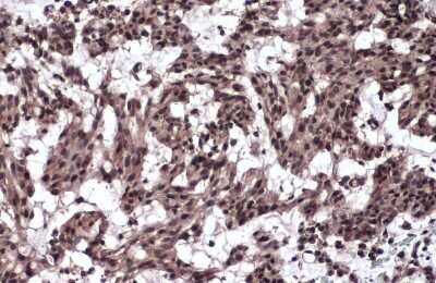 Immunohistochemistry-Paraffin: TIF1 gamma Antibody [NBP3-13036]
