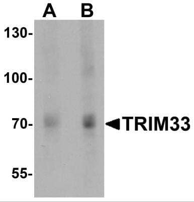 Western Blot: TIF1 gamma AntibodyBSA Free [NBP2-81762]