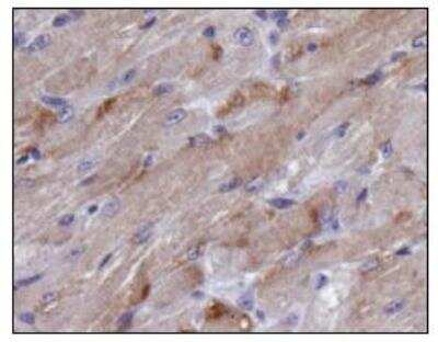 Immunohistochemistry: TIGAR/C12orf5 Antibody - BSA Free [NBP1-49534]