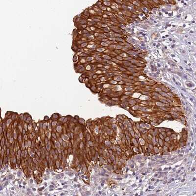Immunohistochemistry: TIGAR/C12orf5 Antibody [NBP2-38462]