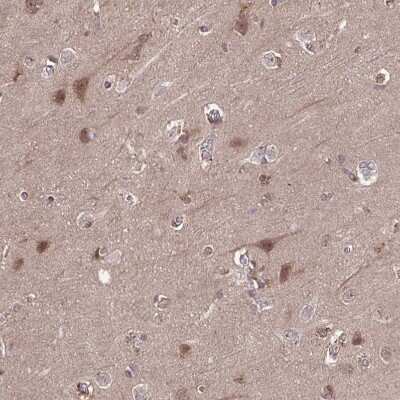 Immunohistochemistry-Paraffin: TIGAR/C12orf5 Antibody [NBP2-38522]