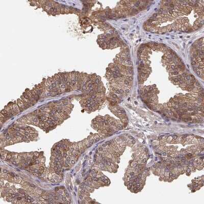 Immunohistochemistry-Paraffin: TIGAR/C12orf5 Antibody [NBP2-38522]