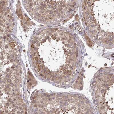 Immunohistochemistry-Paraffin: TIGAR/C12orf5 Antibody [NBP2-38522]