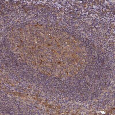 Immunohistochemistry-Paraffin: TIGAR/C12orf5 Antibody [NBP2-38522]