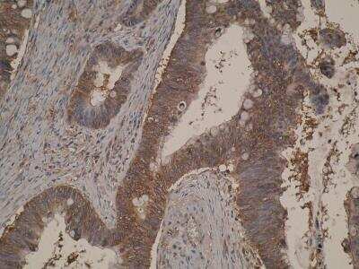 Immunohistochemistry: TIGAR/C12orf5 Antibody (M2-P4H2) - BSA Free [NB100-2698]