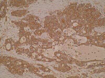 Immunohistochemistry: TIGAR/C12orf5 Antibody (M2-P4H2) - BSA Free [NB100-2698]