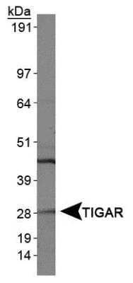 Western Blot: TIGAR/C12orf5 AntibodyBSA Free [NBP1-49534]