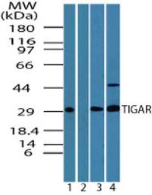 Western Blot: TIGAR/C12orf5 Antibody [NBP2-24754]