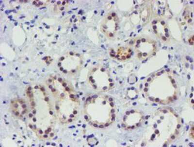 Immunohistochemistry-Paraffin: TIGD1 Antibody (OTI4G9) [NBP2-03877]