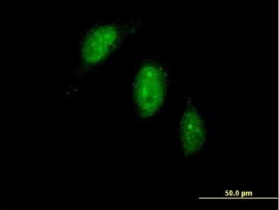 Immunocytochemistry/ Immunofluorescence: TIGD1 Antibody [H00200765-B01P]
