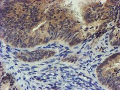 Immunohistochemistry: TIGD1 Antibody (OTI4G9) - Azide and BSA Free [NBP2-74519]