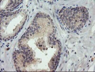 Immunohistochemistry: TIGD1 Antibody (OTI4G9) - Azide and BSA Free [NBP2-74519]