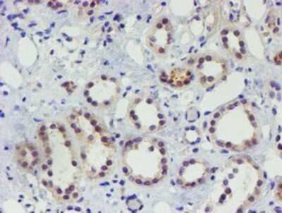 Immunohistochemistry: TIGD1 Antibody (OTI4G9) - Azide and BSA Free [NBP2-74519]