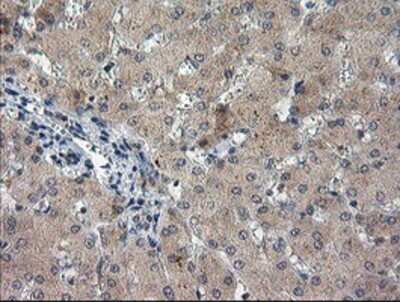 Immunohistochemistry: TIGD1 Antibody (OTI4G9) - Azide and BSA Free [NBP2-74519]