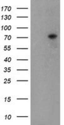 Western Blot: TIGD1 Antibody (OTI4G9)Azide and BSA Free [NBP2-74519]