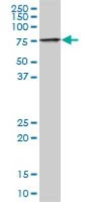 Western Blot: TIGD1 Antibody [H00200765-B01P]