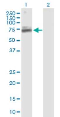 Western Blot: TIGD1 Antibody [H00200765-B01P]