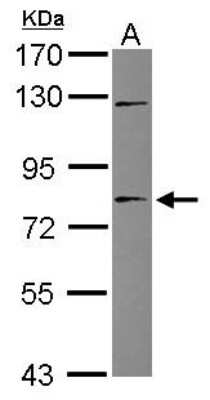 Western Blot: TIGD1 Antibody [NBP2-20640]