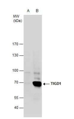 Western Blot: TIGD1 Antibody [NBP2-20640]