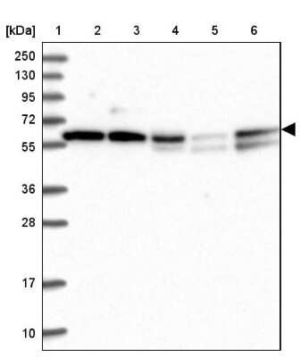 Western Blot: TIGD1 Antibody [NBP2-47606]