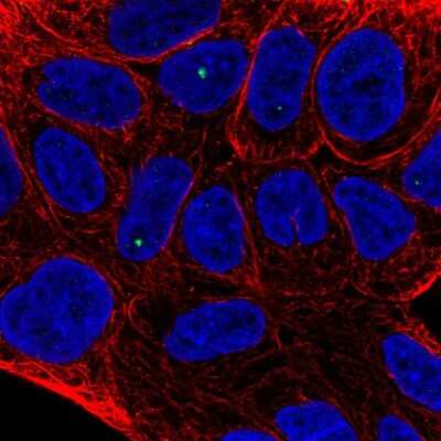 Immunocytochemistry/ Immunofluorescence: TIGD2 Antibody [NBP2-56967]