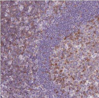 Immunohistochemistry-Paraffin: TIGD2 Antibody [NBP2-30631]