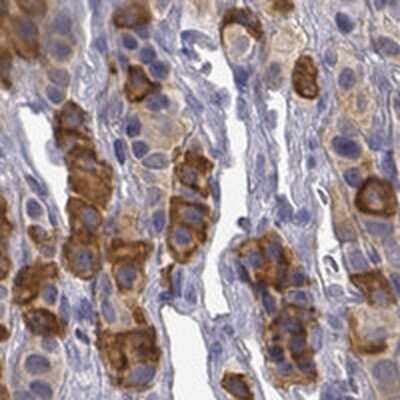 Immunohistochemistry-Paraffin: TIGD4 Antibody [NBP3-17318]