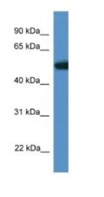 Western Blot: TIGD4 Antibody [NBP1-74161]