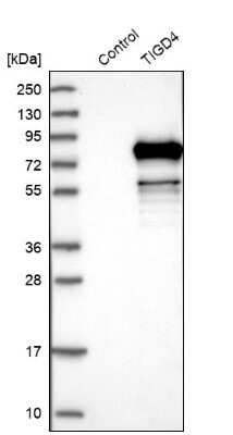 Western Blot: TIGD4 Antibody [NBP1-86303]