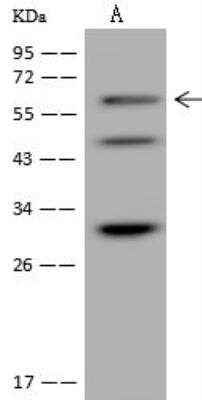 Western Blot: TIGD4 Antibody [NBP3-12604]