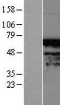 Western Blot: TIGD4 Overexpression Lysate [NBL1-16913]