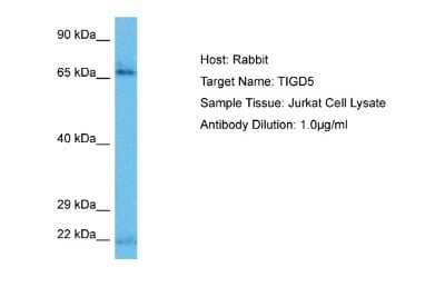 Western Blot: TIGD5 Antibody [NBP3-09618]