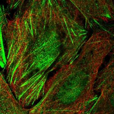 Immunocytochemistry/ Immunofluorescence: TIGD6 Antibody [NBP1-92508]