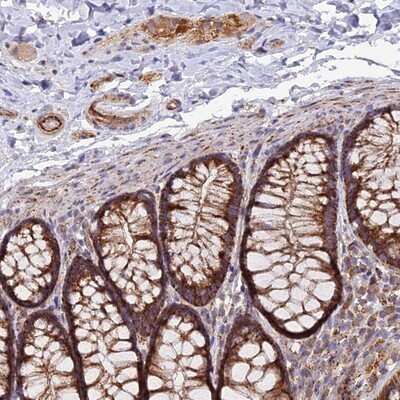 Immunohistochemistry-Paraffin: TIGD6 Antibody [NBP1-92508]