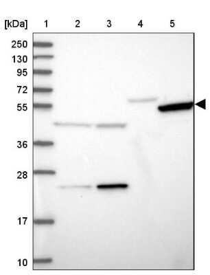 Western Blot: TIGD6 Antibody [NBP1-92508]