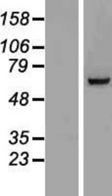 Western Blot: TIGD6 Overexpression Lysate [NBP2-06149]