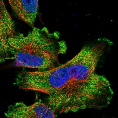 Immunocytochemistry/ Immunofluorescence: TIGD7 Antibody [NBP1-80790]