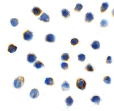 Immunocytochemistry/ Immunofluorescence: TIGIT Antibody (2C6) - VHH - Azide and BSA Free [NBP3-12833]