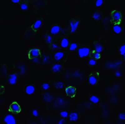 Immunocytochemistry/ Immunofluorescence: TIGIT Antibody (2C6) - VHH - Azide and BSA Free [NBP3-12833]