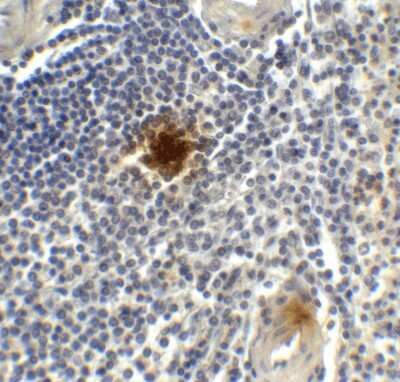 Immunohistochemistry: TIGIT Antibody (2C6) - VHH - Azide and BSA Free [NBP3-12833]