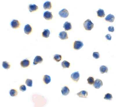 Immunocytochemistry/ Immunofluorescence: TIGIT Antibody (2D7) - VHH - Azide and BSA Free [NBP3-12835]