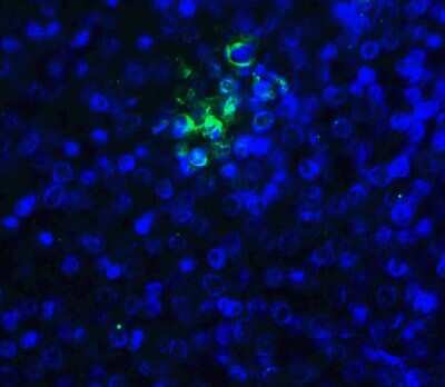 Immunocytochemistry/ Immunofluorescence: TIGIT Antibody (2F7) - VHH - Azide and BSA Free [NBP3-12832]