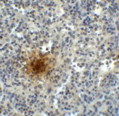 Immunohistochemistry: TIGIT Antibody (2F7) - VHH - Azide and BSA Free [NBP3-12832]