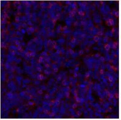 Immunohistochemistry: TIGIT Antibody (BLR047F) [NBP3-14674]