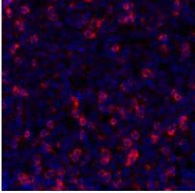 Immunohistochemistry: TIGIT Antibody (BLR047F) [NBP3-14674]