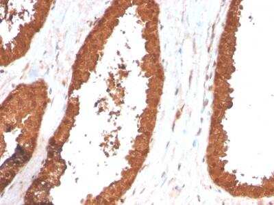 Immunohistochemistry-Paraffin: TIGIT Antibody (TIGIT/3017) - Azide and BSA Free [NBP2-79927]