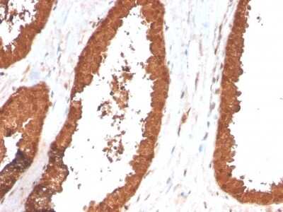 Immunohistochemistry-Paraffin: TIGIT Antibody (TIGIT/3017) [NBP2-79793]