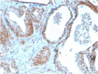 Immunohistochemistry-Paraffin: TIGIT Antibody (TIGIT/3106) - Azide and BSA Free [NBP2-79928]